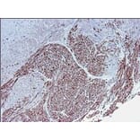 Immunohistochemistry - Anti-Smoothelin Antibody [R4A] (A115642) - Antibodies.com