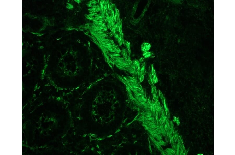 Immunohistochemistry - Anti-Smoothelin Antibody [R4A] (A115642) - Antibodies.com