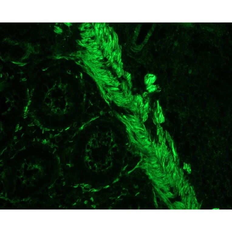 Immunohistochemistry - Anti-Smoothelin Antibody [R4A] (A115642) - Antibodies.com