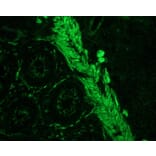 Immunohistochemistry - Anti-Smoothelin Antibody [R4A] (A115642) - Antibodies.com