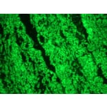 Immunohistochemistry - Anti-Smoothelin Antibody [R4A] (A115642) - Antibodies.com
