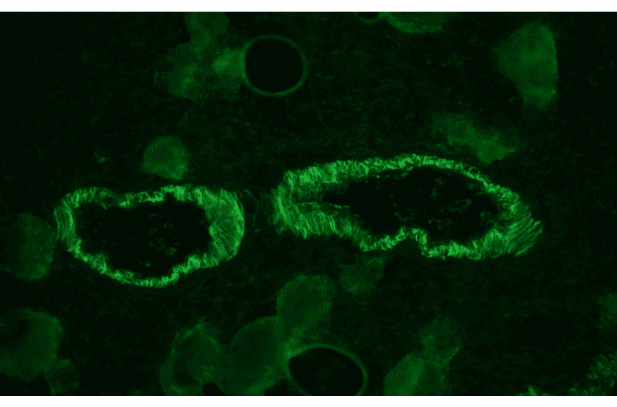 Immunohistochemistry - Anti-Smoothelin Antibody [R4A] (A115642) - Antibodies.com