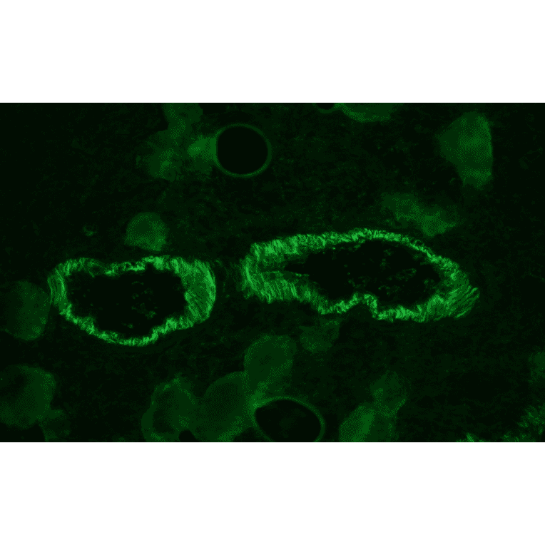 Immunohistochemistry - Anti-Smoothelin Antibody [R4A] (A115642) - Antibodies.com