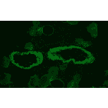 Immunohistochemistry - Anti-Smoothelin Antibody [R4A] (A115642) - Antibodies.com