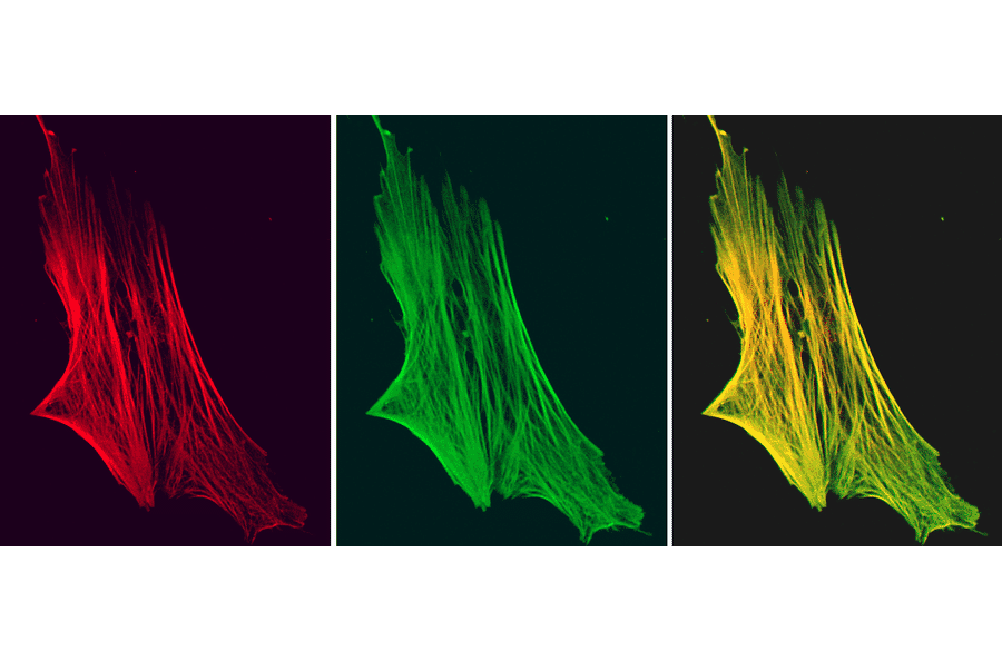 Immunofluorescence - Anti-Smoothelin Antibody [R4A] (A115642) - Antibodies.com