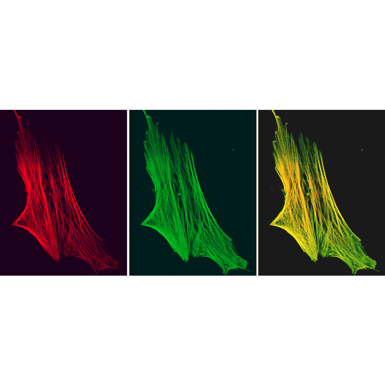 Immunofluorescence - Anti-Smoothelin Antibody [R4A] (A115642) - Antibodies.com