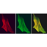 Immunofluorescence - Anti-Smoothelin Antibody [R4A] (A115642) - Antibodies.com