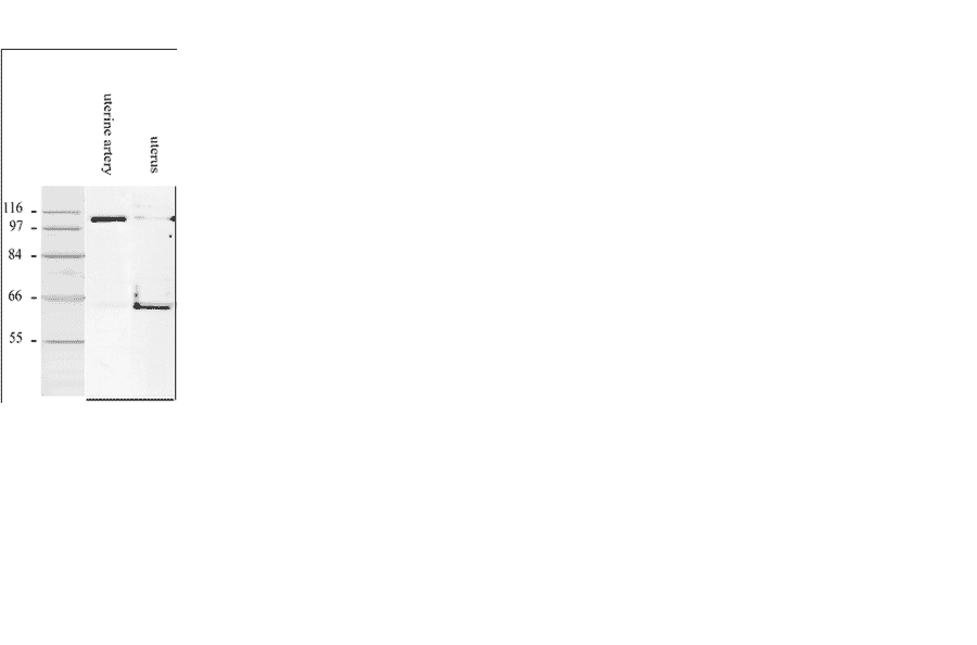 Western Blot - Anti-Smoothelin Antibody [R4A] (A115642) - Antibodies.com
