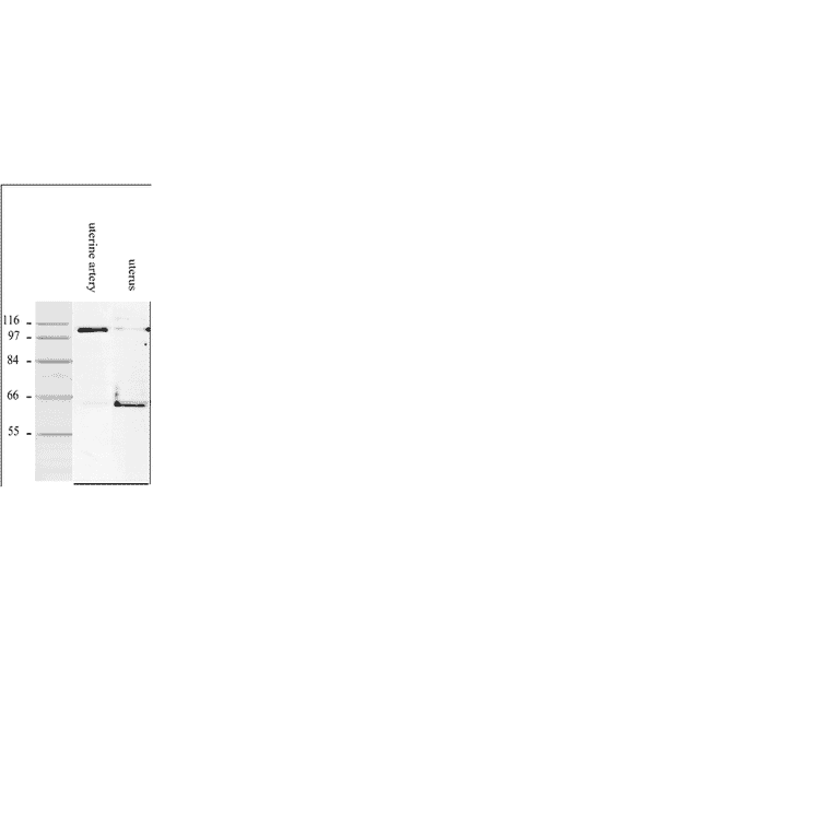 Western Blot - Anti-Smoothelin Antibody [R4A] (A115642) - Antibodies.com