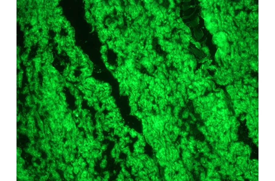 Immunofluorescence - Anti-Smoothelin Antibody [R4A] (A115642) - Antibodies.com
