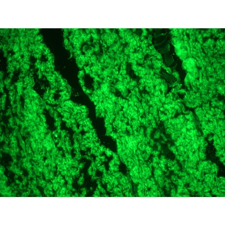 Immunofluorescence - Anti-Smoothelin Antibody [R4A] (A115642) - Antibodies.com
