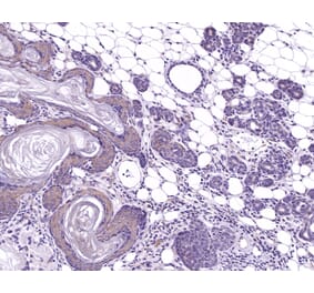 Immunohistochemistry - Anti-TIAM1 Antibody (A115644) - Antibodies.com