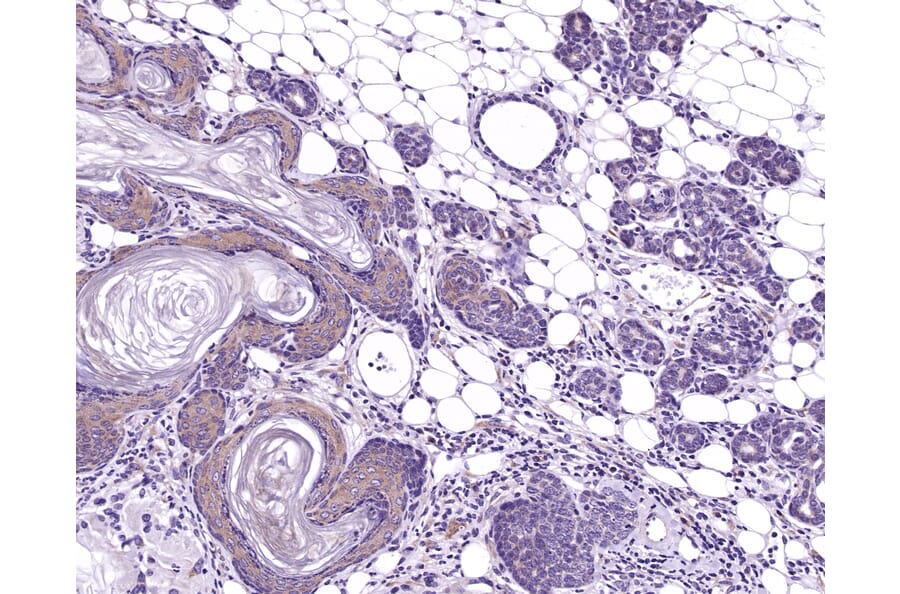 Immunohistochemistry - Anti-TIAM1 Antibody (A115644) - Antibodies.com