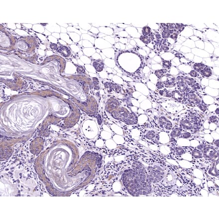 Immunohistochemistry - Anti-TIAM1 Antibody (A115644) - Antibodies.com