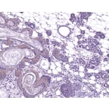 Immunohistochemistry - Anti-TIAM1 Antibody (A115644) - Antibodies.com