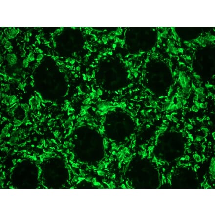 Immunofluorescence - Anti-Vimentin Antibody [RV202] (FITC) (A115649) - Antibodies.com