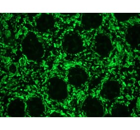 Immunohistochemistry - Anti-Vimentin Antibody [RV202] (A115651) - Antibodies.com