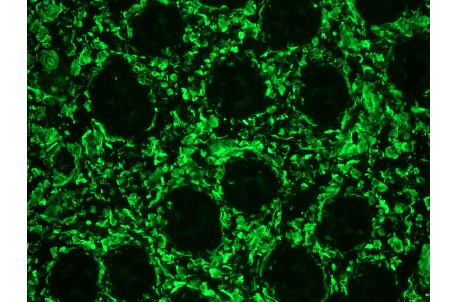 Immunohistochemistry - Anti-Vimentin Antibody [RV202] (A115651) - Antibodies.com