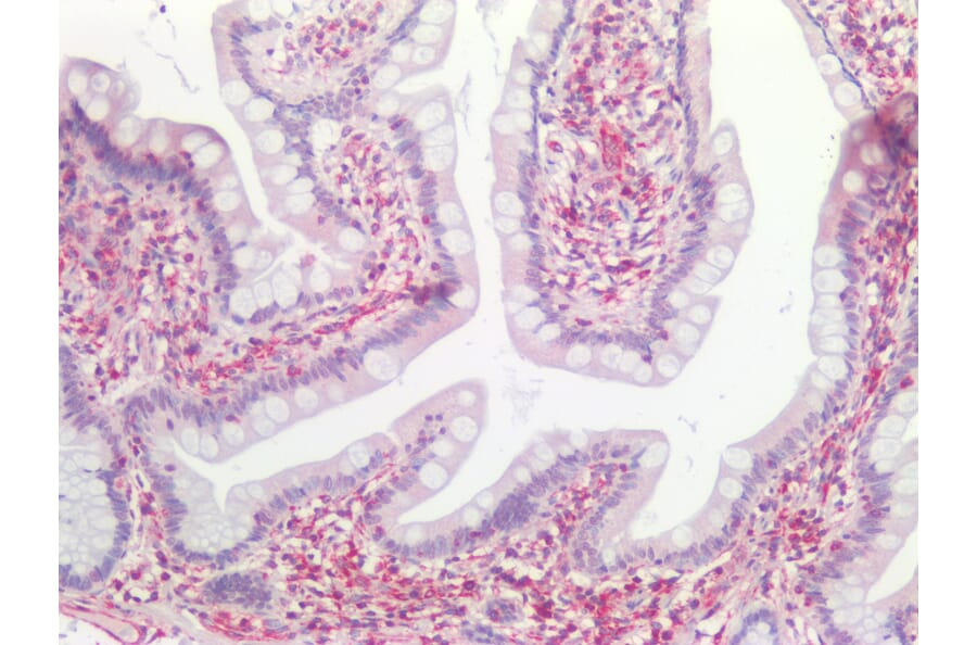 Immunohistochemistry - Anti-Vimentin Antibody [RV202] (A115651) - Antibodies.com