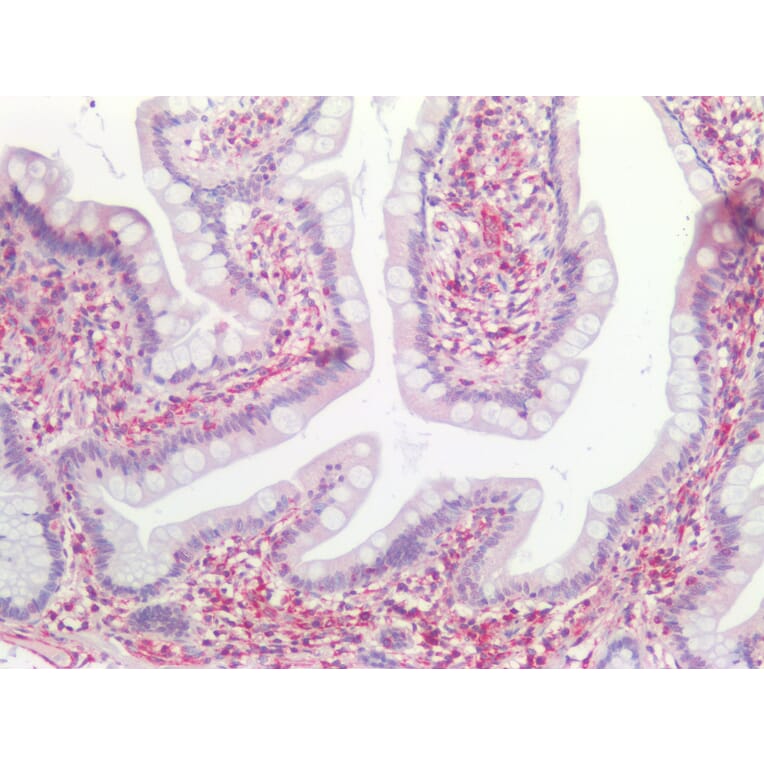 Immunohistochemistry - Anti-Vimentin Antibody [RV202] (A115651) - Antibodies.com