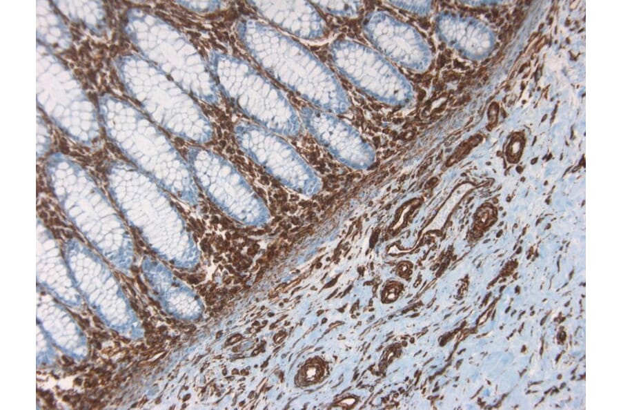 Immunohistochemistry - Anti-Vimentin Antibody [RV202] (A115651) - Antibodies.com