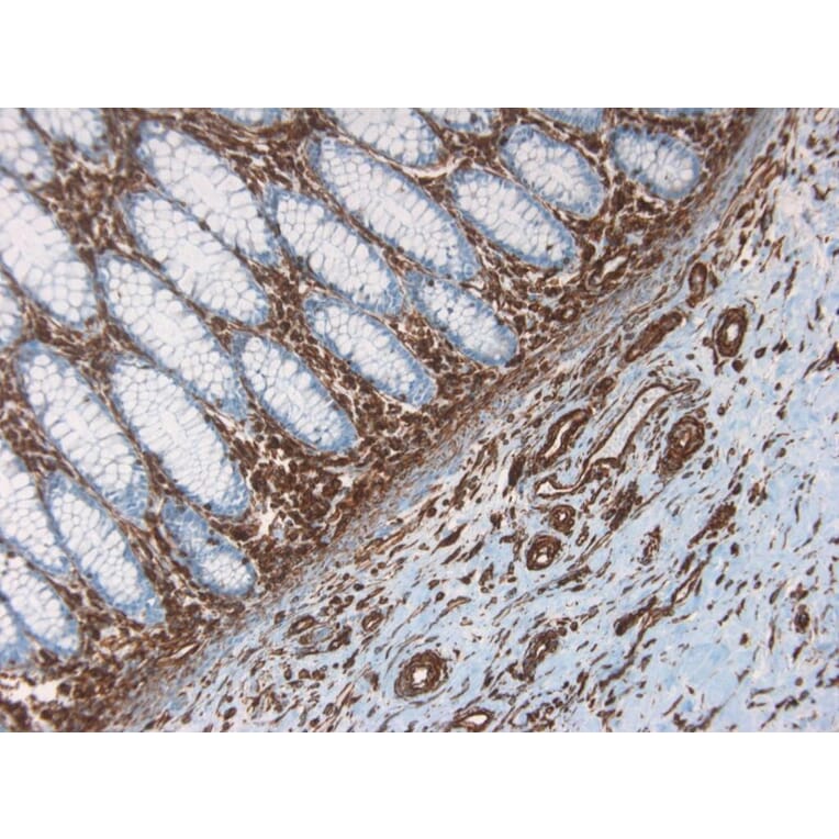 Immunohistochemistry - Anti-Vimentin Antibody [RV202] (A115651) - Antibodies.com