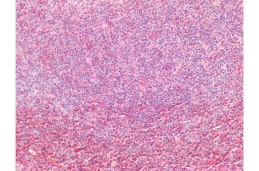 Immunohistochemistry - Anti-Vimentin Antibody [RV202] (A115651) - Antibodies.com