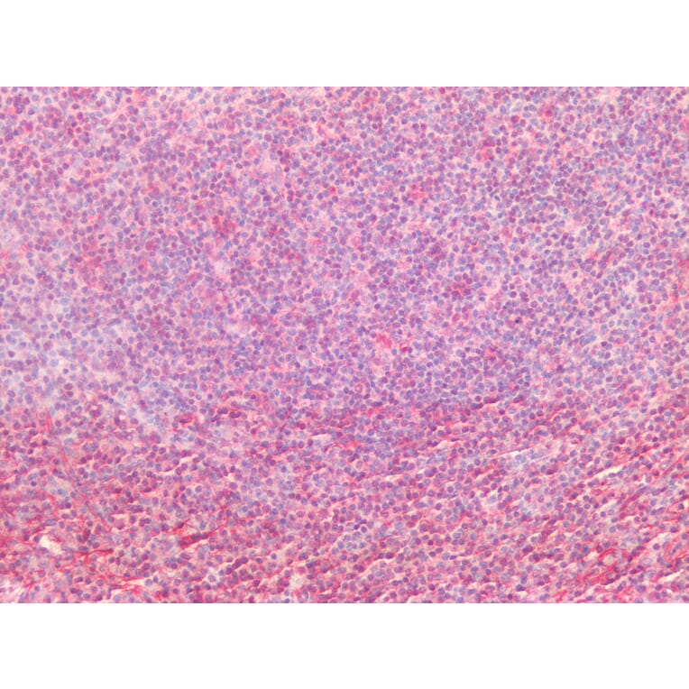 Immunohistochemistry - Anti-Vimentin Antibody [RV202] (A115651) - Antibodies.com