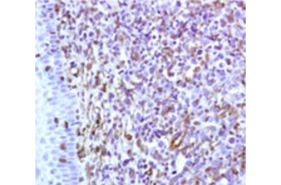 Immunohistochemistry - Anti-Vimentin Antibody [RV202] (A115651) - Antibodies.com