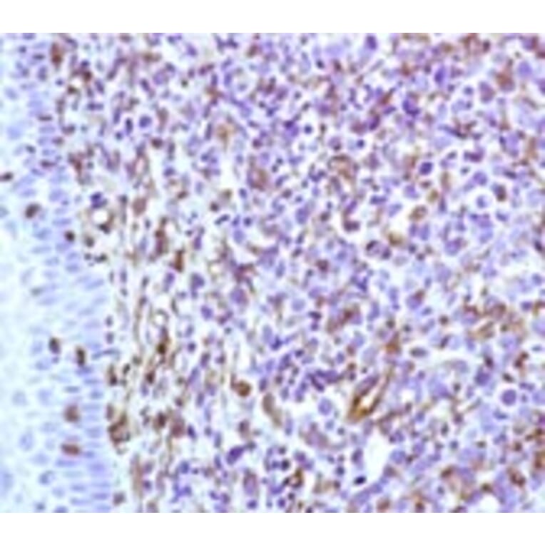 Immunohistochemistry - Anti-Vimentin Antibody [RV202] (A115651) - Antibodies.com