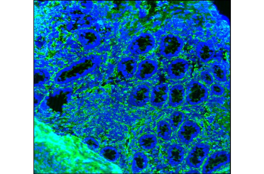 Immunohistochemistry - Anti-Vimentin Antibody [RV202] (A115651) - Antibodies.com