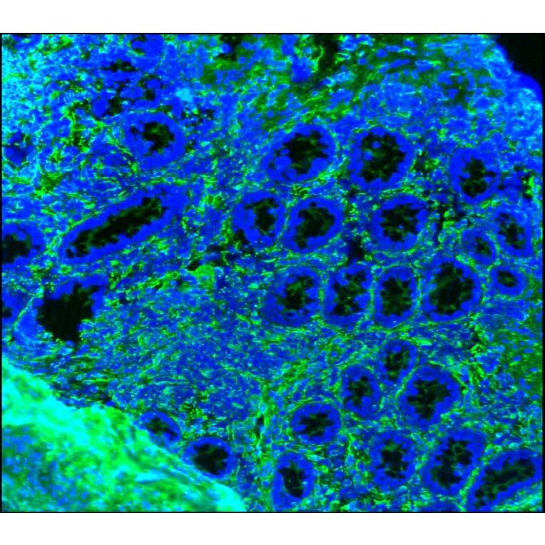 Immunohistochemistry - Anti-Vimentin Antibody [RV202] (A115651) - Antibodies.com