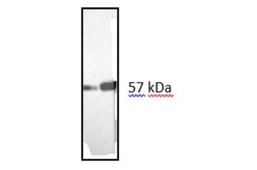 Western Blot - Anti-Vimentin Antibody [RV202] (A115651) - Antibodies.com