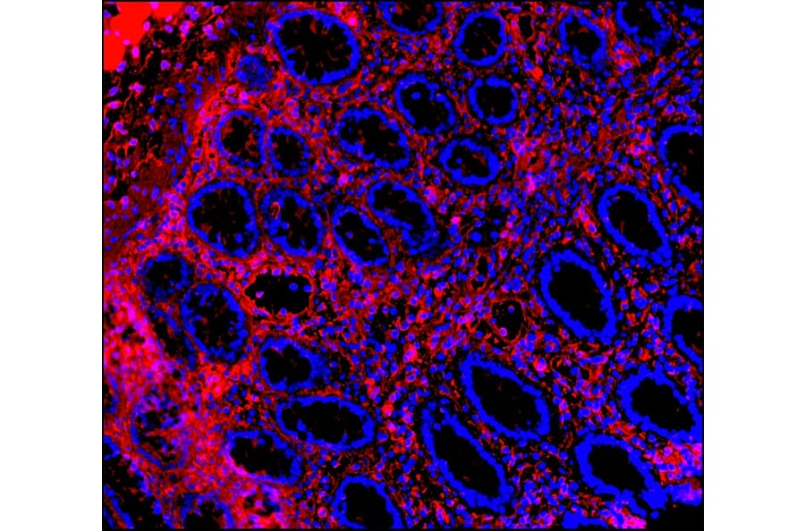 Immunohistochemistry - Anti-Vimentin Antibody [RV202] (A115651) - Antibodies.com