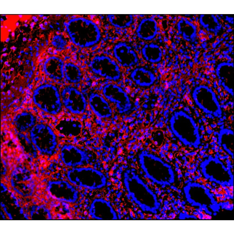 Immunohistochemistry - Anti-Vimentin Antibody [RV202] (A115651) - Antibodies.com