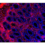 Immunohistochemistry - Anti-Vimentin Antibody [RV202] (A115651) - Antibodies.com