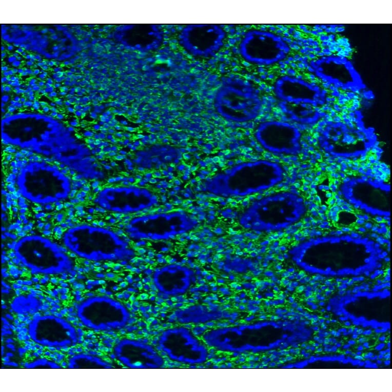 Immunohistochemistry - Anti-Vimentin Antibody [RV202] (A115651) - Antibodies.com