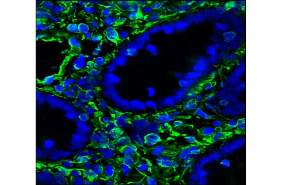 Immunohistochemistry - Anti-Vimentin Antibody [RV202] (A115651) - Antibodies.com