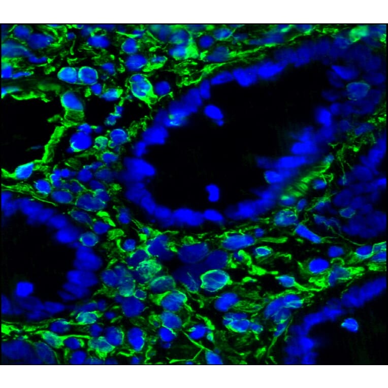 Immunohistochemistry - Anti-Vimentin Antibody [RV202] (A115651) - Antibodies.com