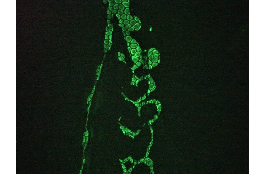 Immunohistochemistry - Anti-Vimentin Antibody [RV202] (A115651) - Antibodies.com