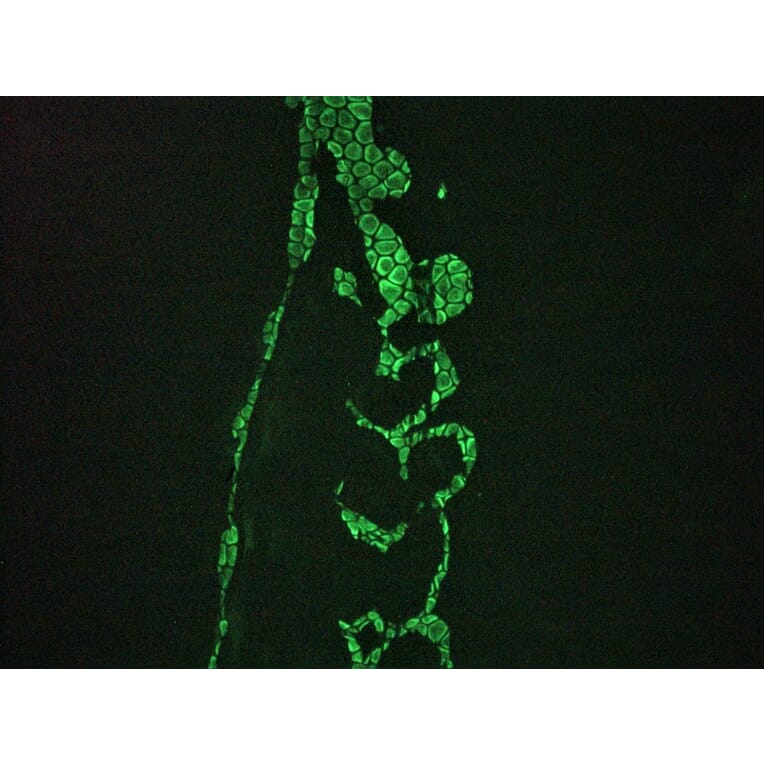 Immunohistochemistry - Anti-Vimentin Antibody [RV202] (A115651) - Antibodies.com
