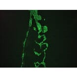 Immunohistochemistry - Anti-Vimentin Antibody [RV202] (A115651) - Antibodies.com