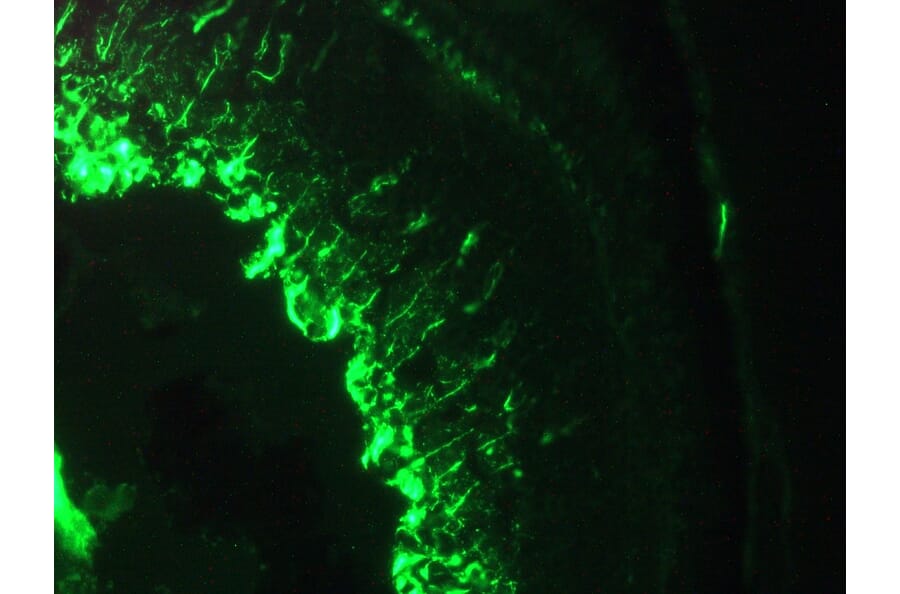 Immunohistochemistry - Anti-Vimentin Antibody [RV202] (A115651) - Antibodies.com
