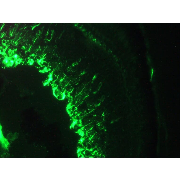Immunohistochemistry - Anti-Vimentin Antibody [RV202] (A115651) - Antibodies.com