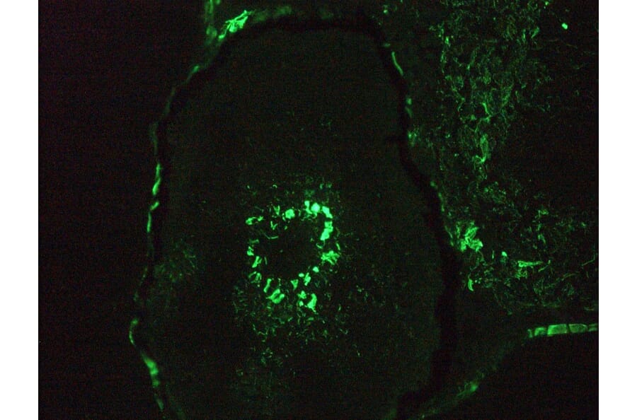 Immunohistochemistry - Anti-Vimentin Antibody [RV202] (A115651) - Antibodies.com