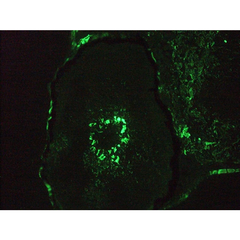 Immunohistochemistry - Anti-Vimentin Antibody [RV202] (A115651) - Antibodies.com