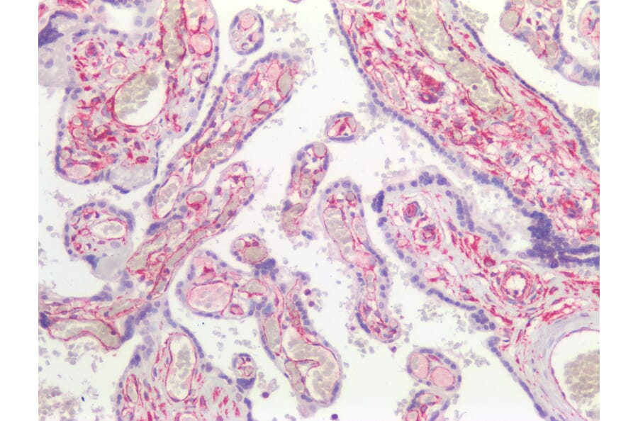 Immunohistochemistry - Anti-Vimentin Antibody [RV202] (A115651) - Antibodies.com