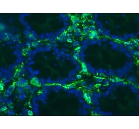 Immunohistochemistry - Anti-Vimentin Antibody [RV203] (A115652) - Antibodies.com