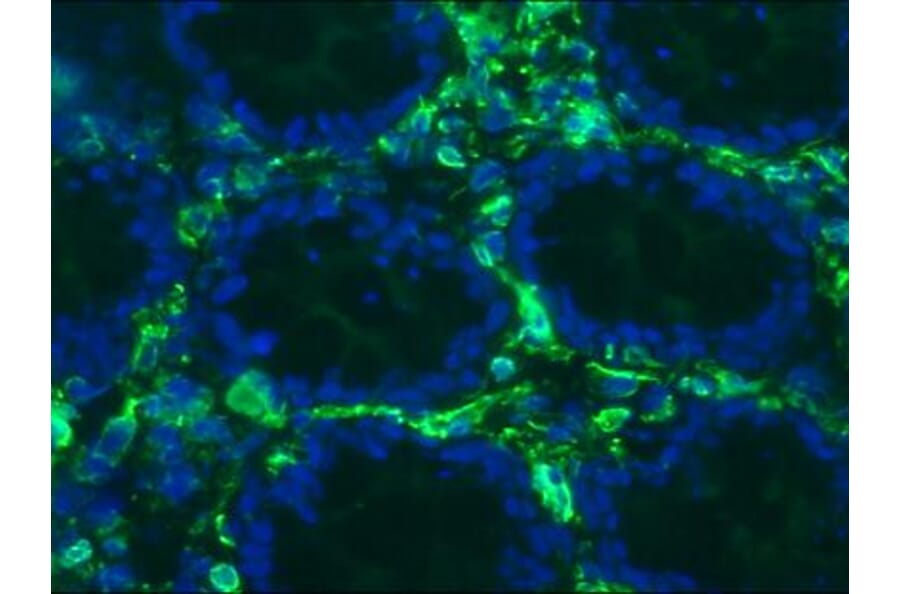 Immunohistochemistry - Anti-Vimentin Antibody [RV203] (A115652) - Antibodies.com