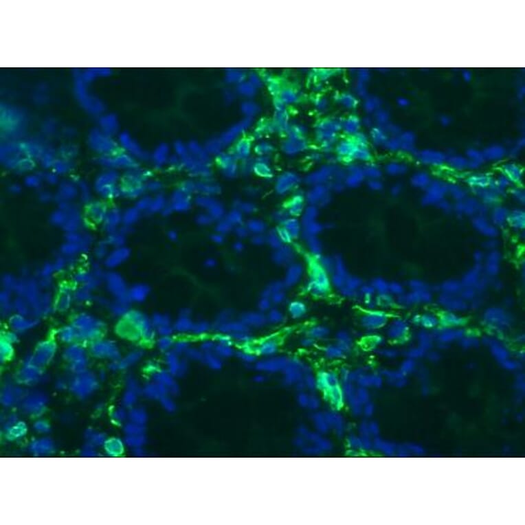 Immunohistochemistry - Anti-Vimentin Antibody [RV203] (A115652) - Antibodies.com
